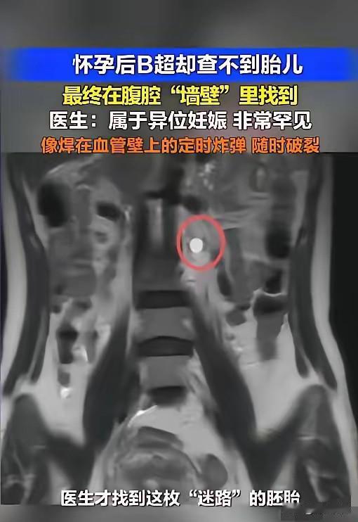 “太惊险了！”5月7日报道，广东深圳，一女子用验孕棒发现自己怀了，她赶紧去了医院