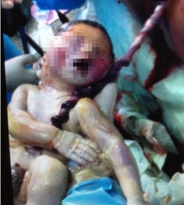 孕妇怀孕期间, 补充大量的营养物质真的好吗?