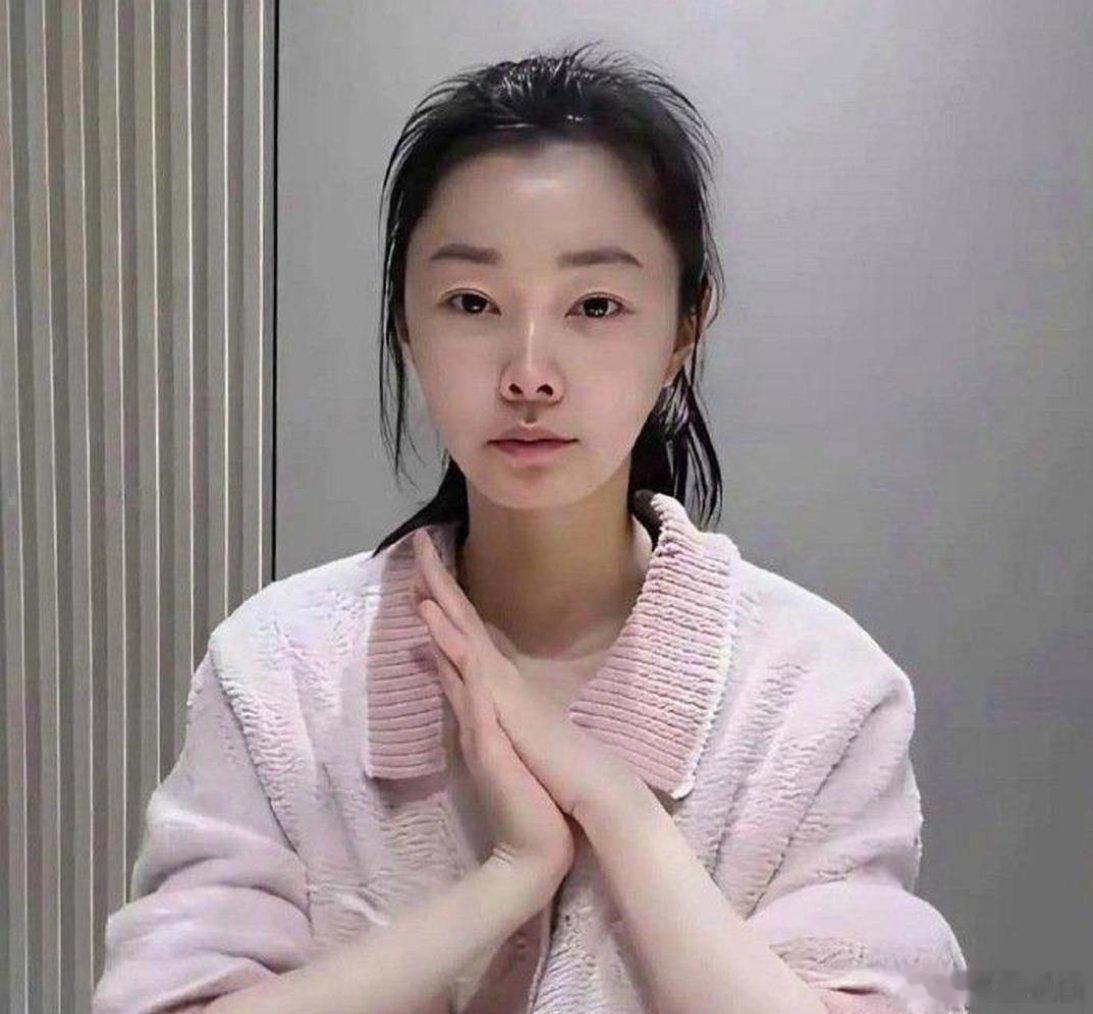 宋轶素颜又出圈了，这次鼻子成为了焦点。