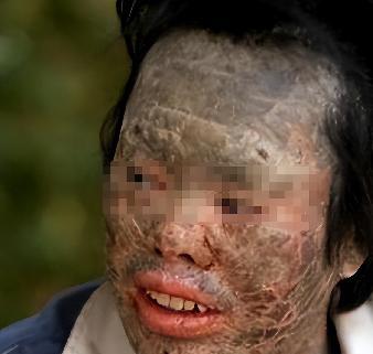 2003年，一男子有爱吃蛇的爱好，不仅顿顿有蛇肉，还必须是新鲜现杀的，村里人都说