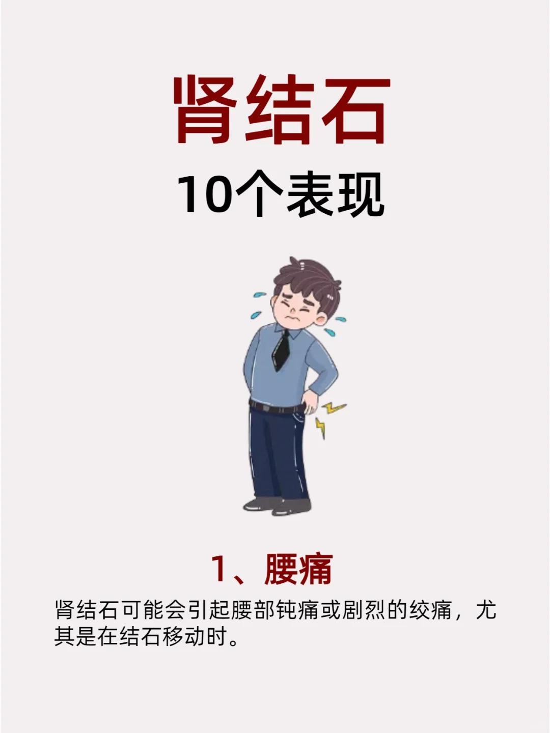 收藏自查！肾结石的10个表现！！
