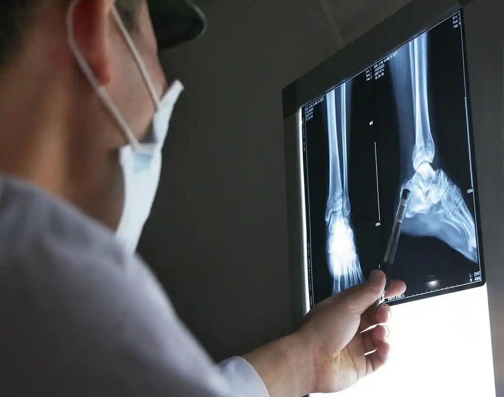 6种癌症骨转移率超90%！医生提醒：出现这6大症状已到高危期！近年来，随着医