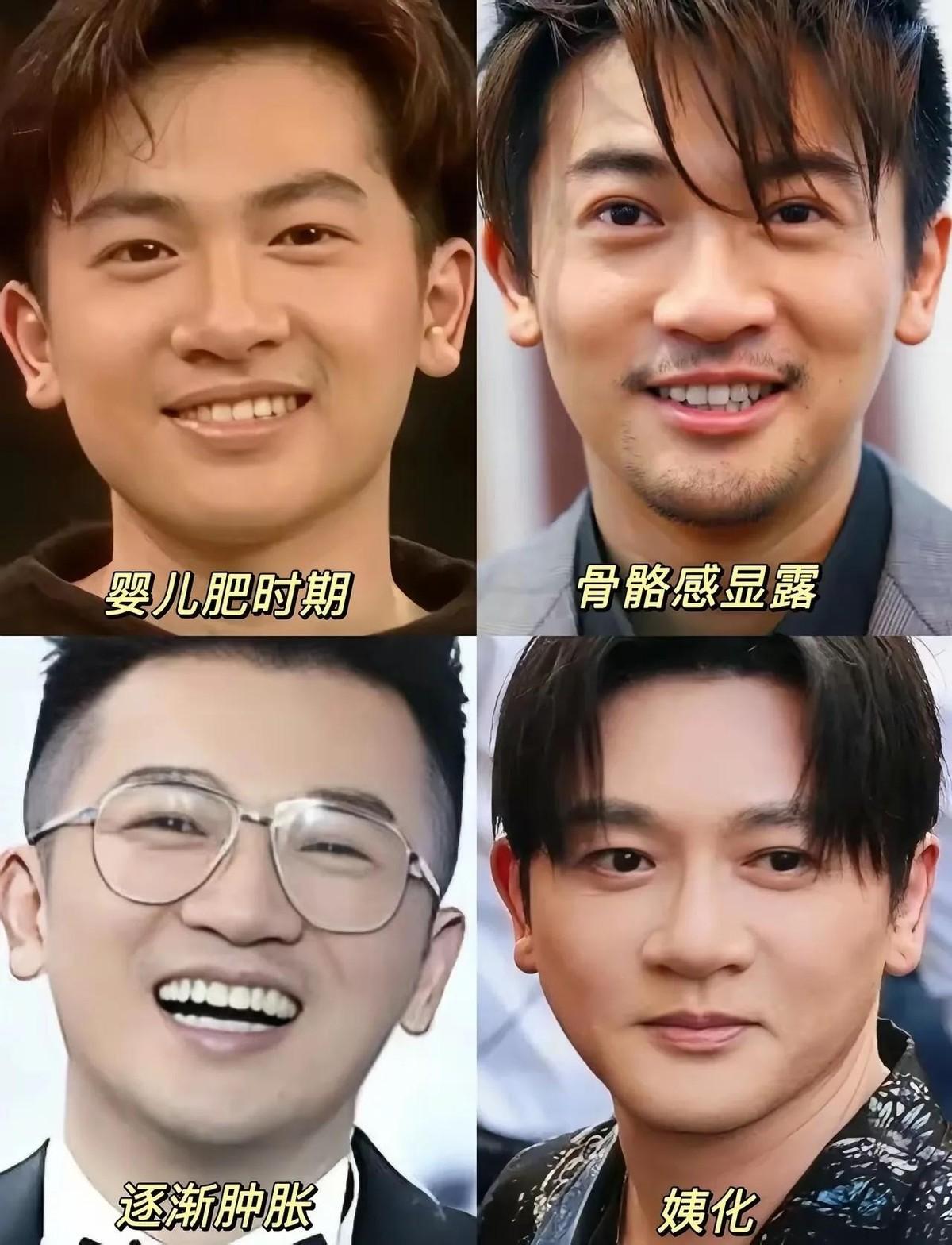 有时候真替这帮男明星急得慌。为了抗老，动刀、填充、提拉，一样没落下。结果呢？男