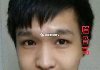 面相中的眉骨可以反映出一个人的性情好坏，是否是个有志气的人。如果眉骨是微微隆起，
