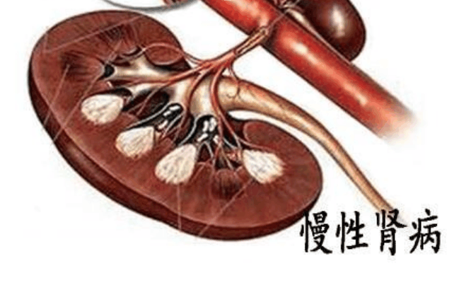 多吃4种食物, 养肾效果看得见! 聪明人都这么吃