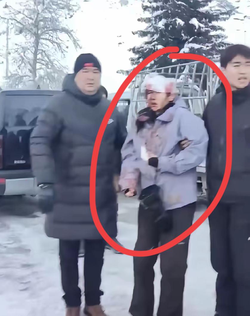 可可托海被咬的游客长这样，她要感谢自己的头盔没摘，还有其他游客的见义勇为，否则遭