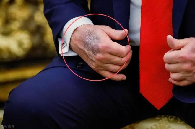 特朗普要是真突然没了，绝不是病死，只有这一种可能！如果事情发生得非常快，那么