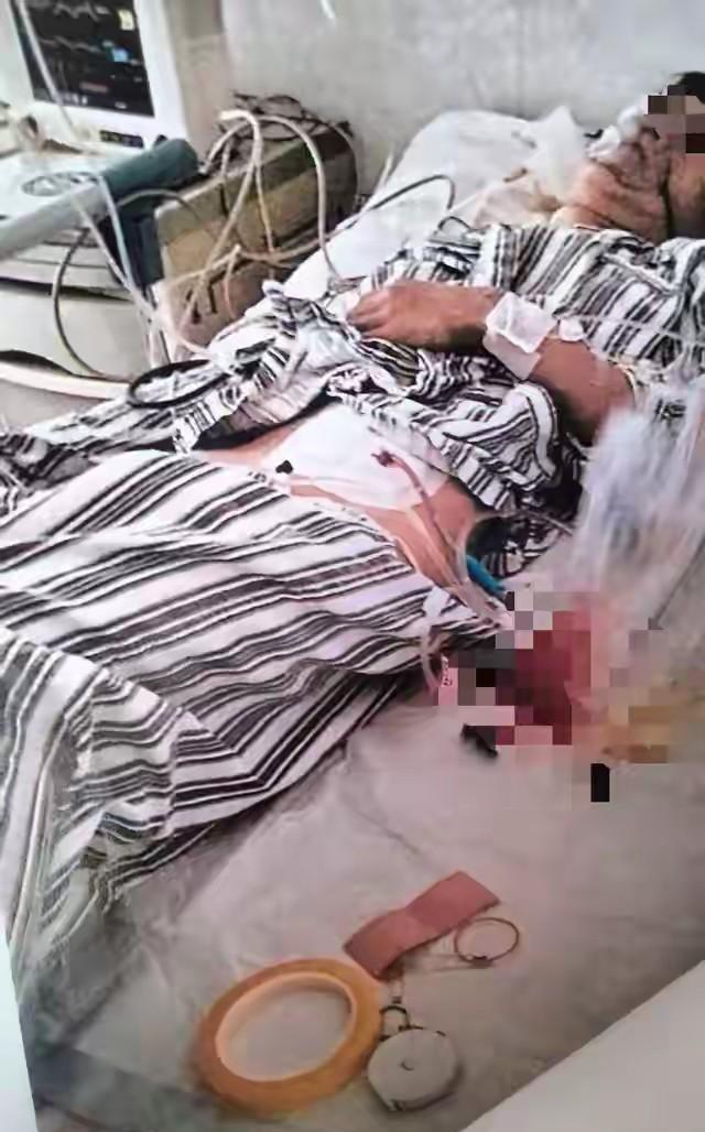 没天理了！云南禄丰，同学叫15岁男孩出去玩，男孩害怕对方打架闹事，就没有去赴约，