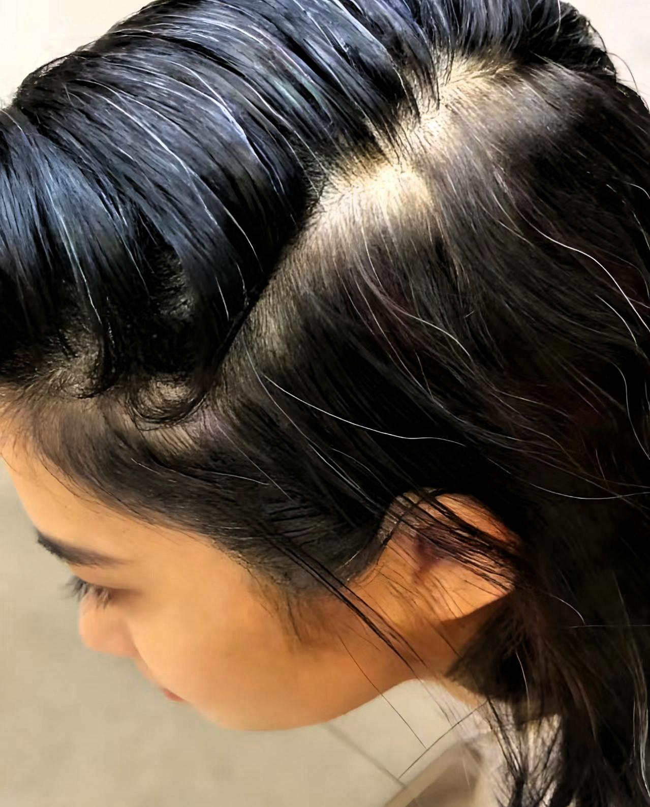 我发现，头发是比较容易发白的女人，都有的一个特点就是，年轻时候头发又多又粗硬，