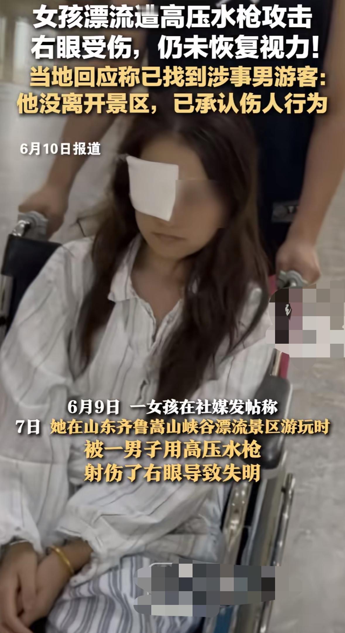 肇事者找到了！女孩玩漂流被人用高压水枪射伤右眼，她发帖寻找目击证人，因为她说射伤