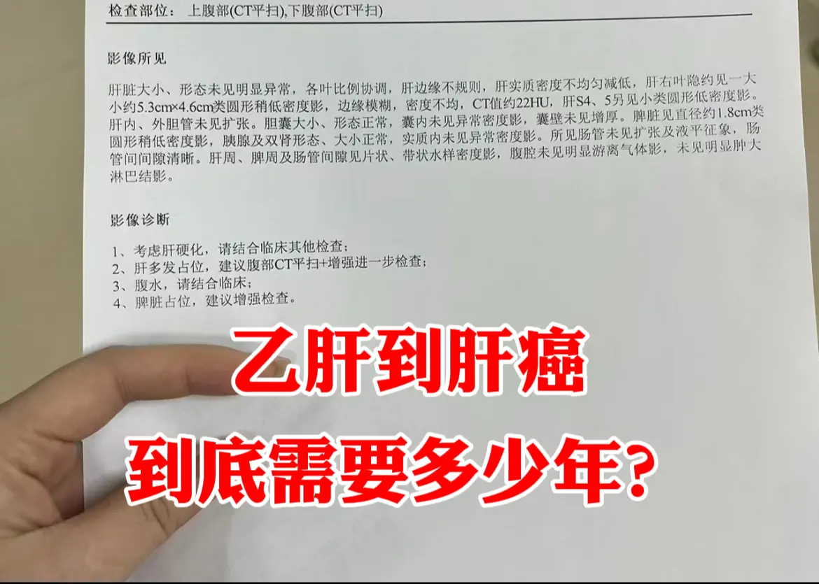 作为一名临床工作30多年的肝病医生，患者有这种顾虑我是很理解的，我也多...