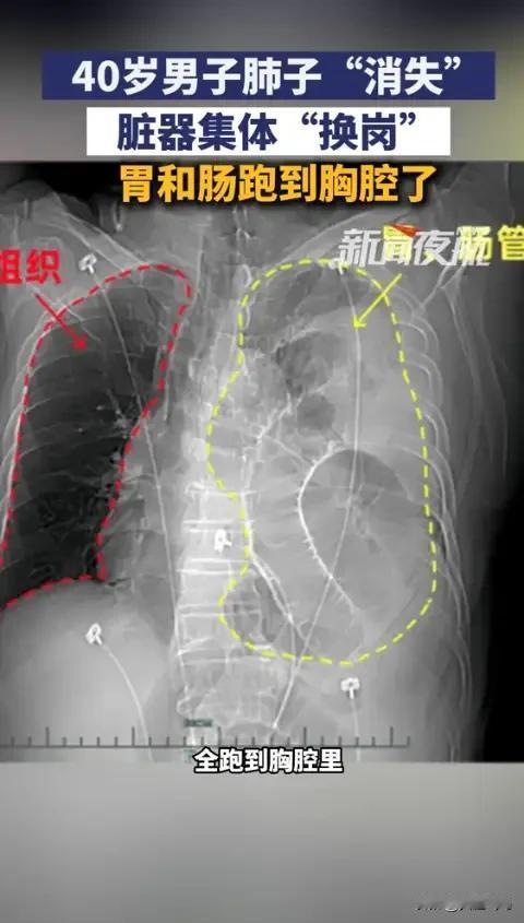 “这就是命！”浙江一男子参加活动抽奖，意外中奖获得了一次免费体检的资格。谁曾想，