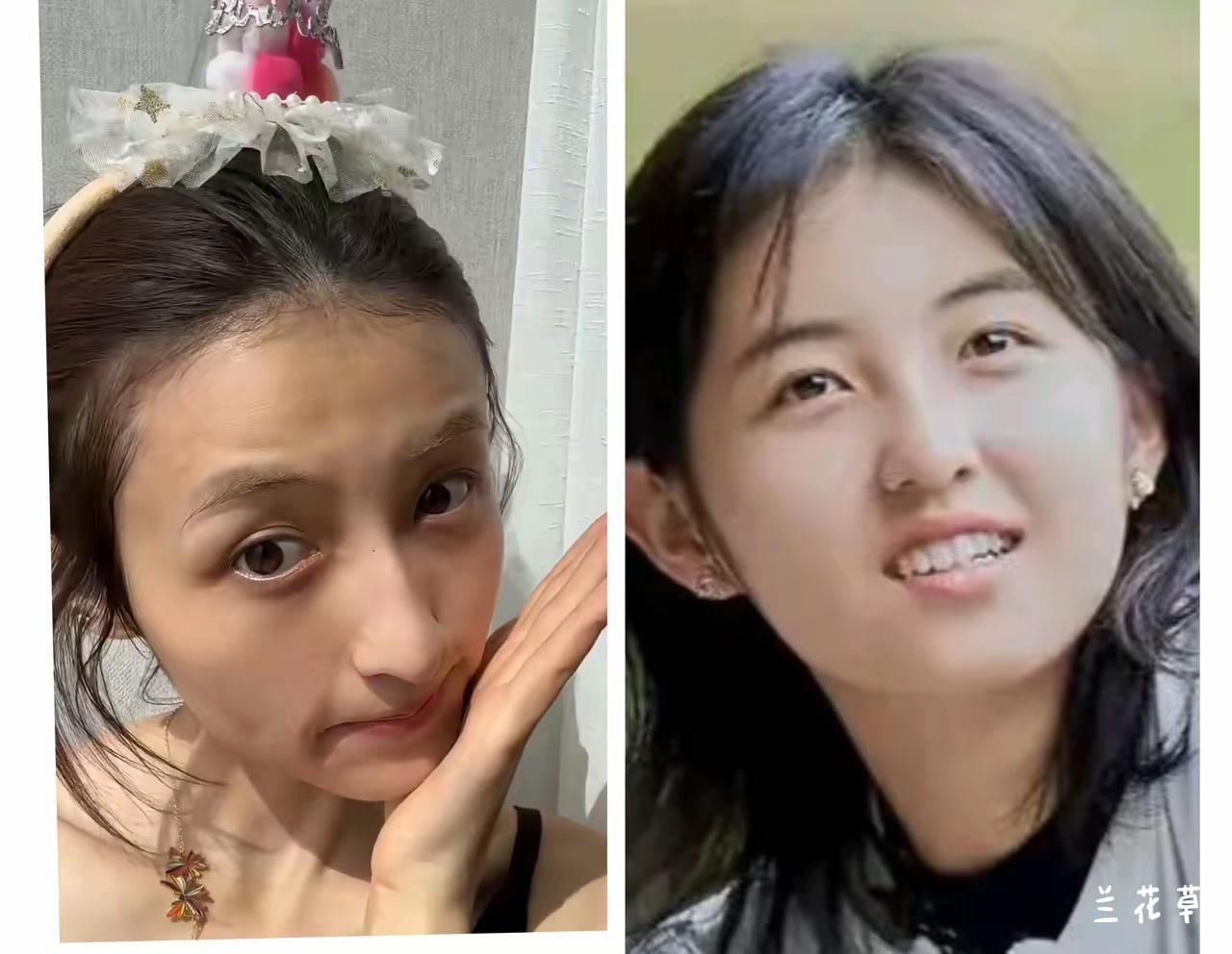 瘦了的张子枫你们还认得吗？一个好好的女孩子，也有一定的演技，脸部表情细腻丰