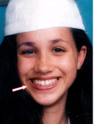 其实梅根也美丽过，不过她长得不大气，不管她笑得有多灿烂，都有种小家子气的感觉。