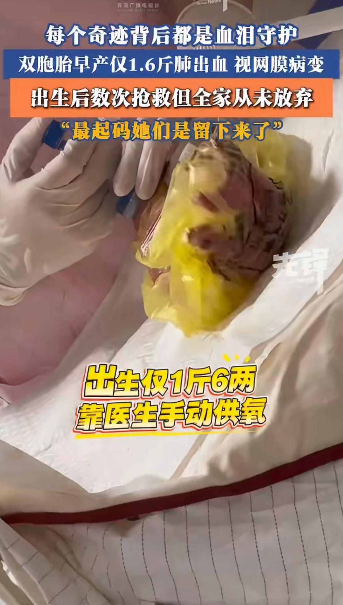 “轻舟已过万重山！”怀胎6个月生下只有1.6斤的双胞胎，医生劝放弃，全家人拼尽全