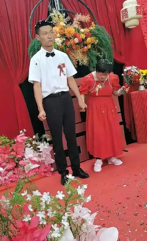 残障人群的婚姻有多难？一唐氏综合征女孩嫁给年轻小伙，陪嫁两套房，一辆奥迪车，