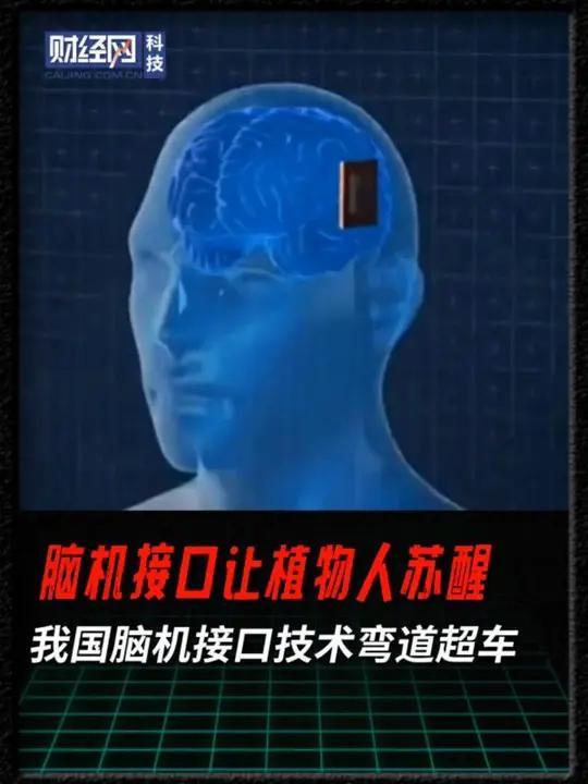 我靠，这下真把“大脑开机键”按下了！全球首例AI脑机接口唤醒植物人成功，20