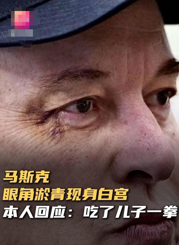 白宫发生激烈打斗？难怪马斯克眼角淤青，班农爆料令美媒一片哗然！前白宫首席战略师史