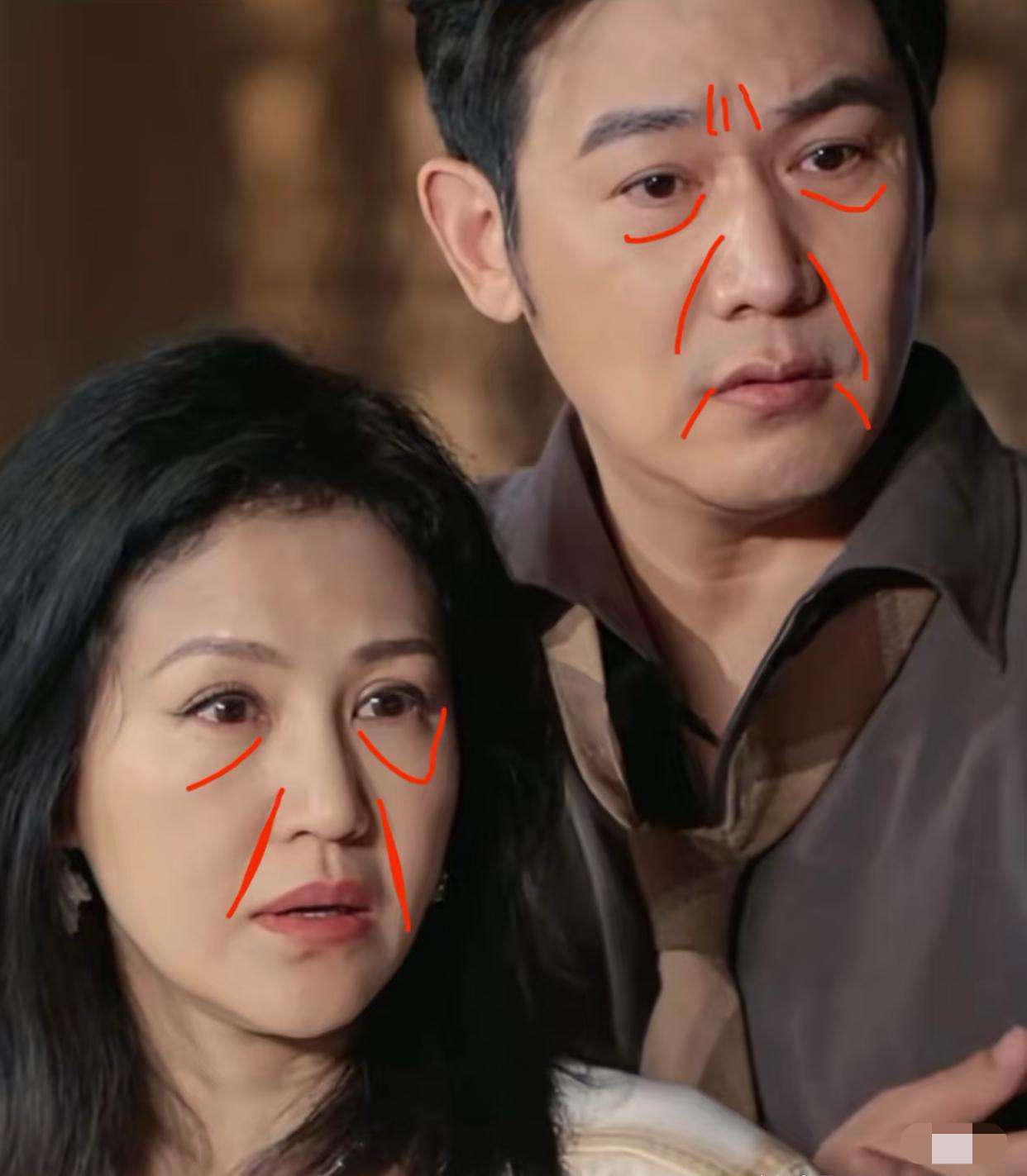 有人问为什么不下垂没皱纹还是能看出年龄，好奇谜底的给你们划重点了，这些线条肌