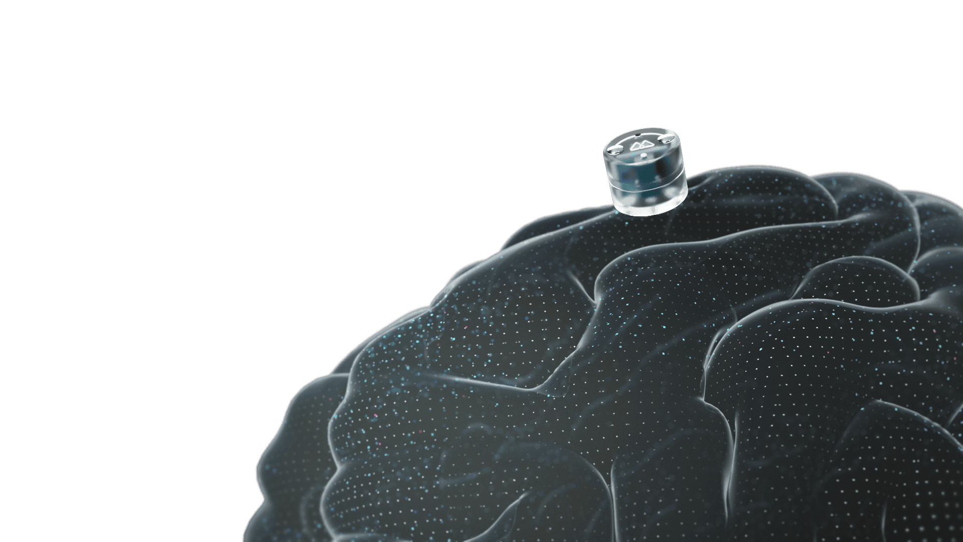 MotifNeurotech非侵入式脑机接口获FDA批准启动抗抑郁临床试验5月