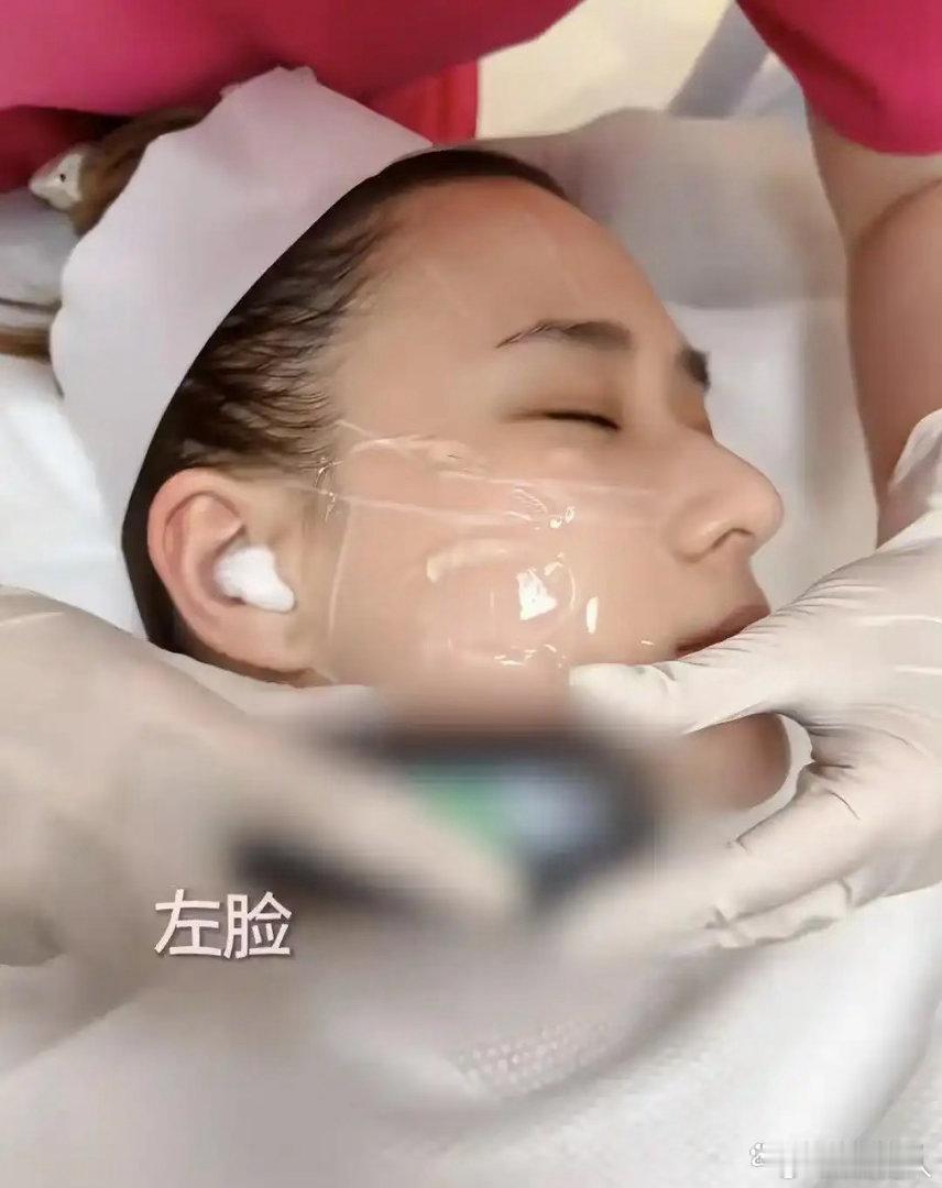 何超莲素颜体验无麻医美，强忍疼痛做完直接约下次。把做医美比作交房租定期续费，豪门千金也逃不过容貌管理