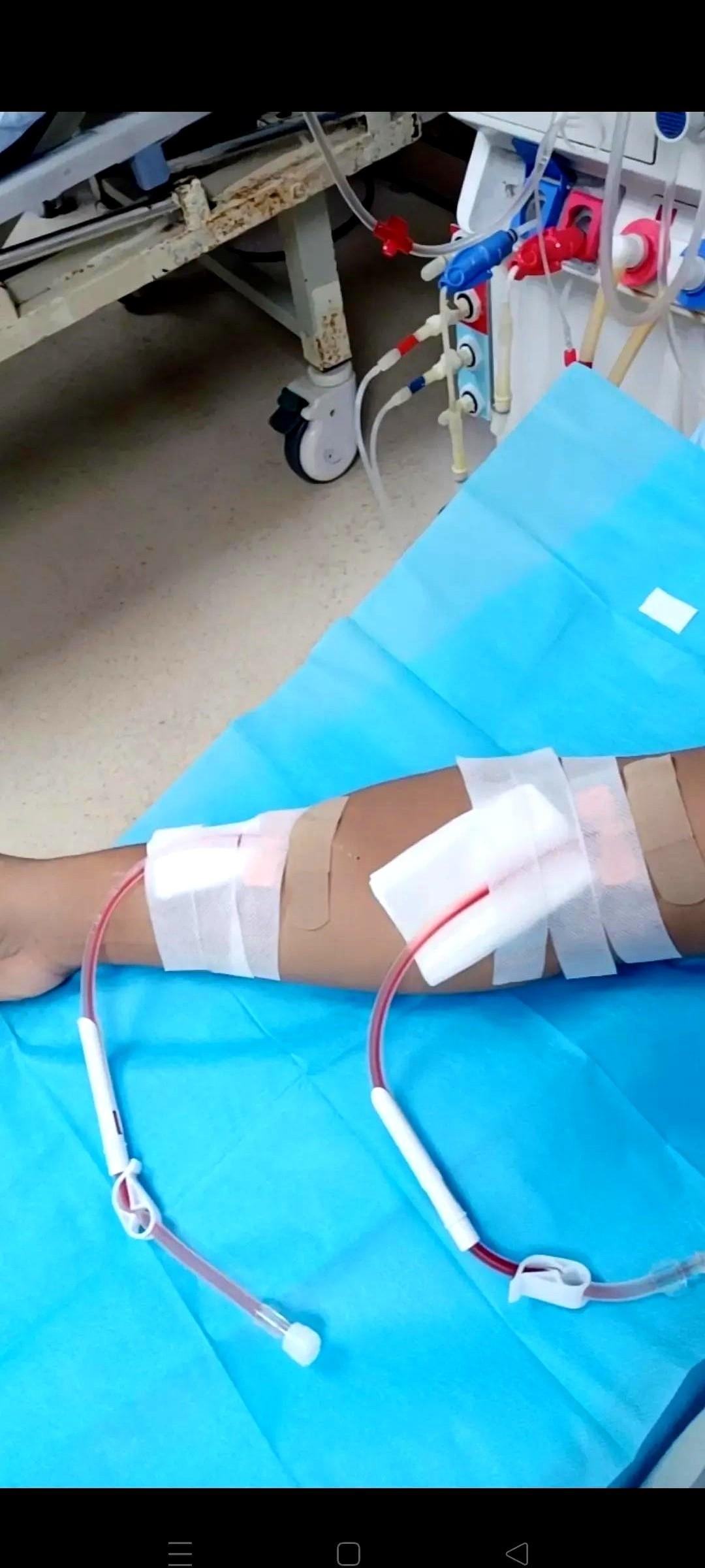 透析室里来了个“神人”，一周只来一次。我当时就懵了。在这儿，一周三次是标配，是