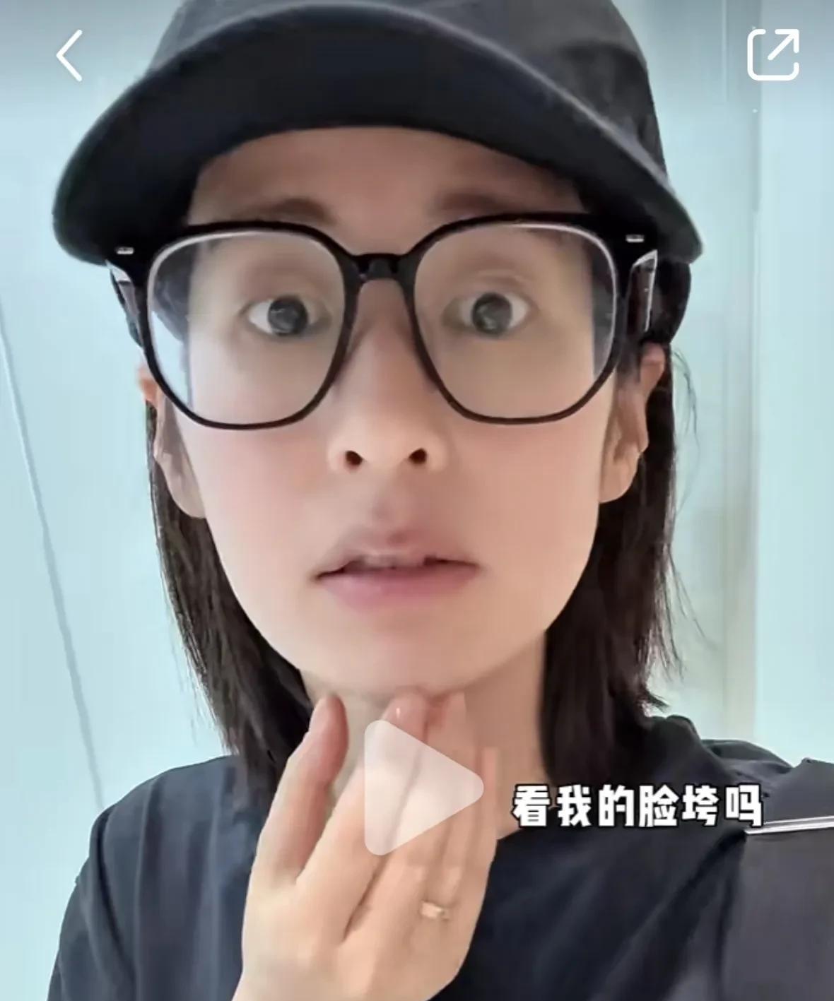 颖儿可是真拼啊！颖儿七月份进组钱打热玛吉，疼得嘶哈的，但是还是坚持下来了！颖儿在