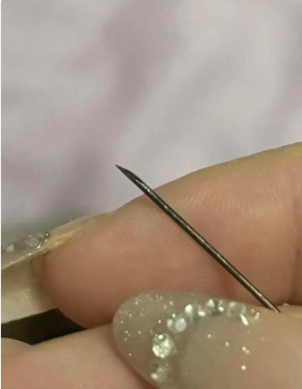 臀部疼了整整一个月，洗澡挤出发黑针头，来源至今成谜浙江一名女子，左臀部持续
