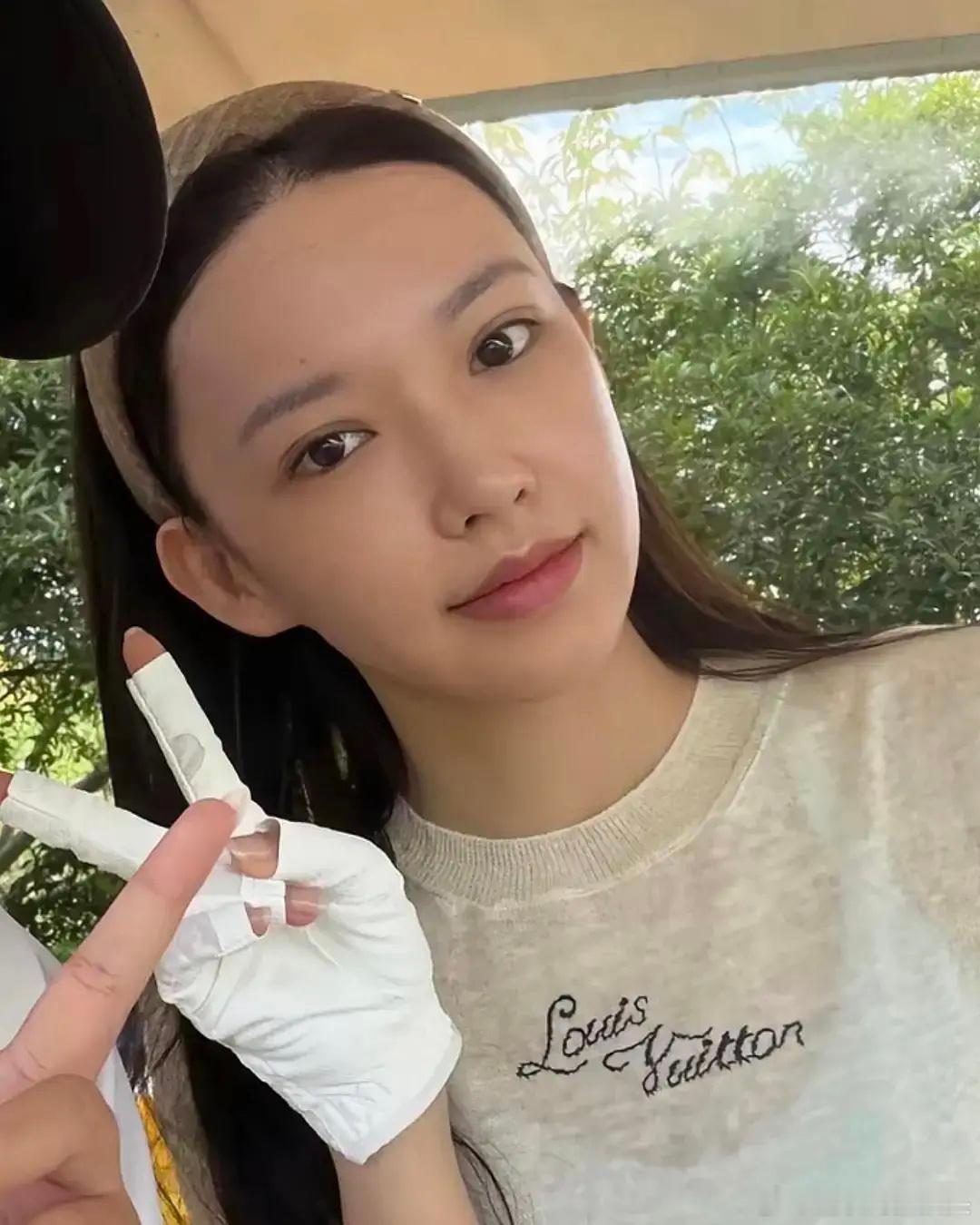 谁敢信这是程潇，眼睛是肿了还是做了医美