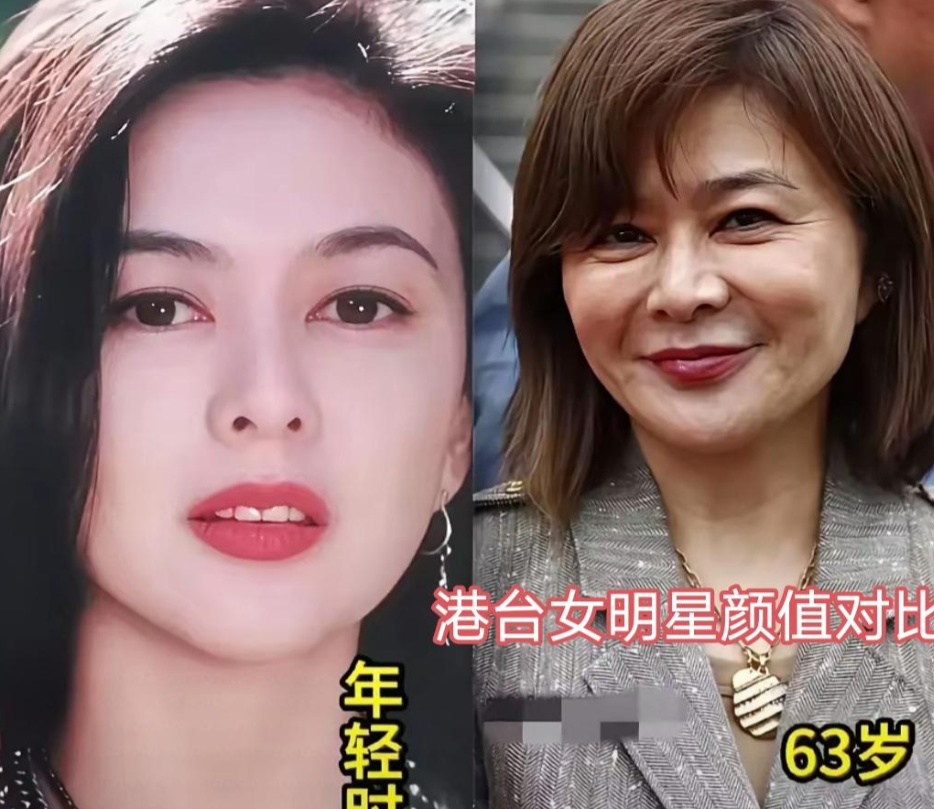 林青霞老了，没动一刀，观众反而更爱她。王祖贤躲国外，照片一出，全网沉默。张曼