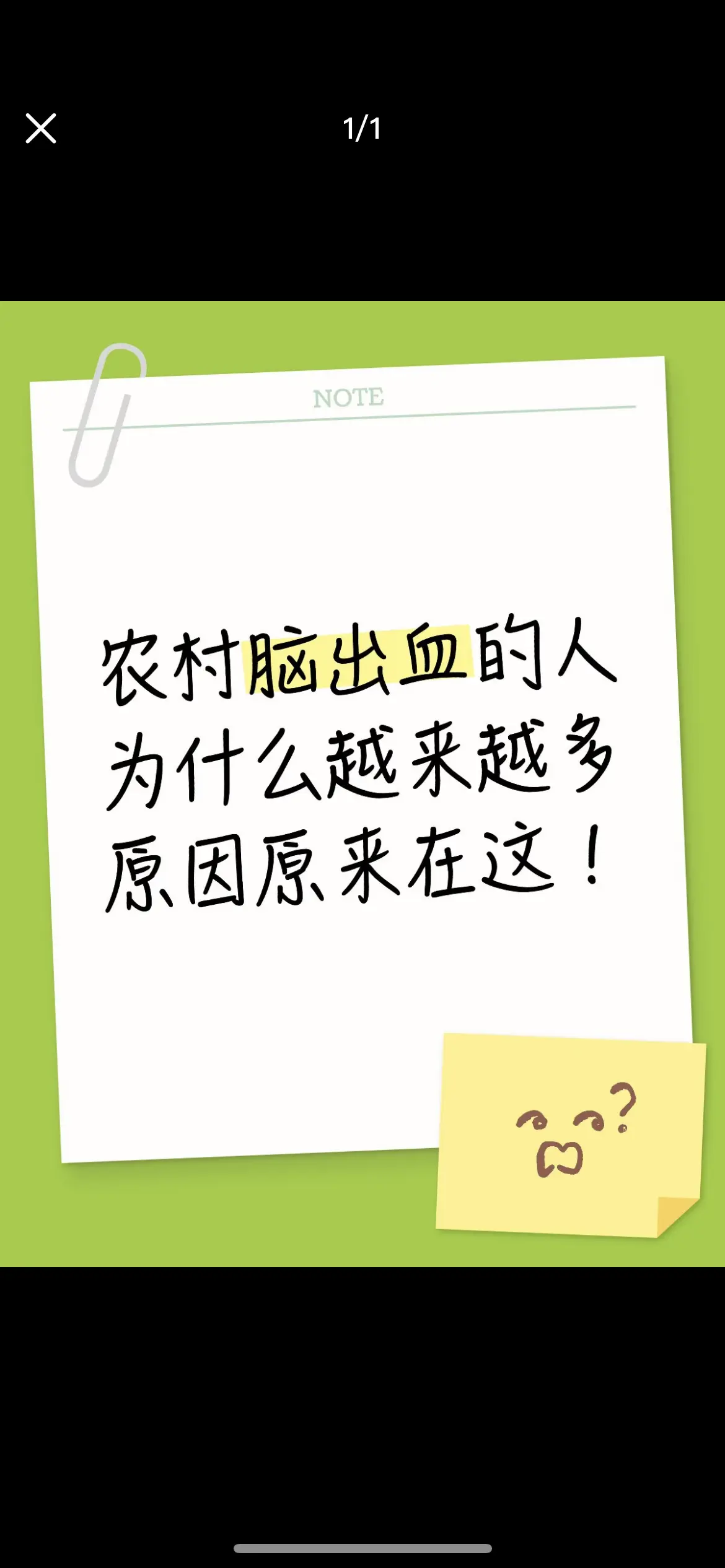 大家好，我是神经外科刘医生。最近接诊能明显发现，农村患上脑出血的乡亲逐...