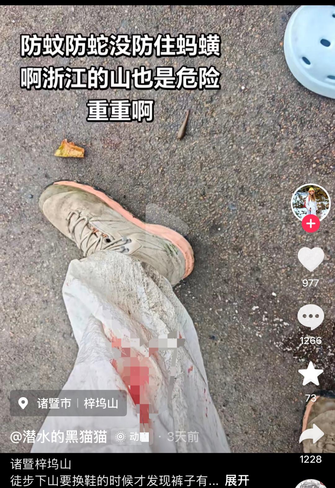 不少人夏天喜欢进山徒步纳凉，做好了防蚊虫、防蛇的准备，却很容易忽略山林里的蚂蟥，