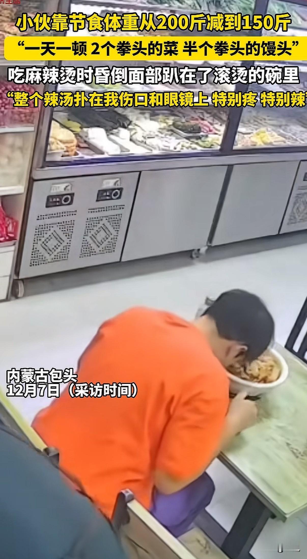 千万不要节食减肥！内蒙古包头，一个小伙子9个月减掉50斤，结果吃饭时脸砸进了滚烫