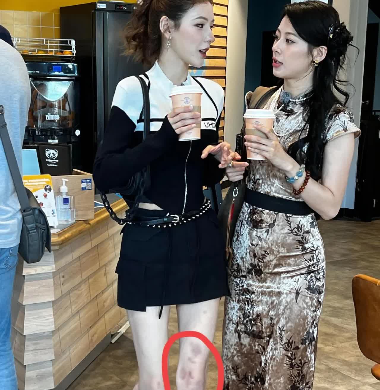 巴黎街头，张予曦和赵昭仪购买咖啡，不过重点在于张予曦这腿是怎么了，伤痕累累！