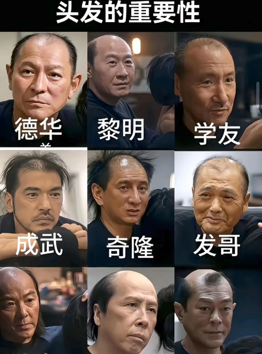 哈哈哈！笑不活了。难怪有人说郑少秋顶了一辈子假发，据说他是秃顶。为了维持