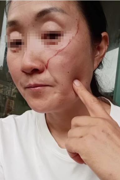 株洲高考母女的母亲，很愚蠢，也不值得同情。都高考结束了，还要女儿保持高考前的