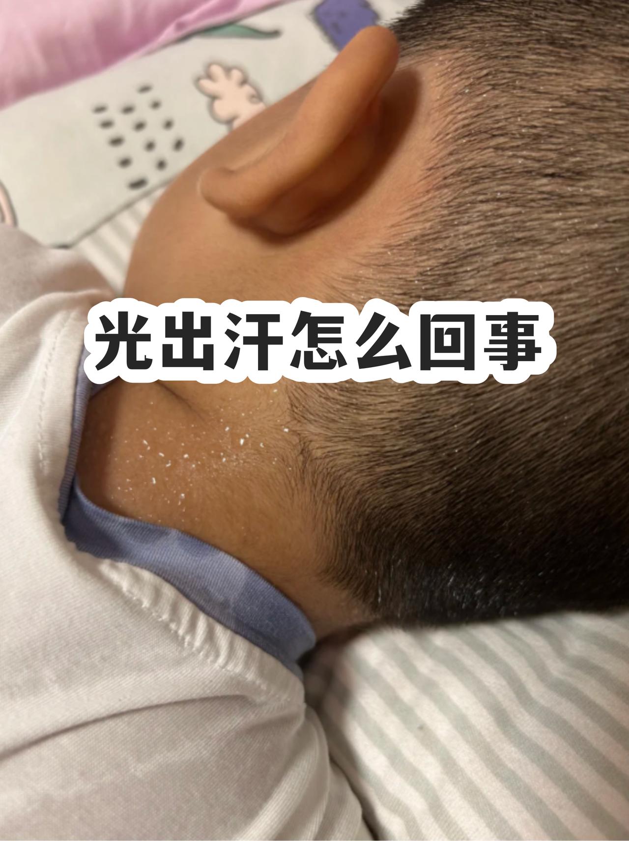 光出汗怎么回事？夏日出汗极为常见。我此前夏天出门，没走几步便汗流