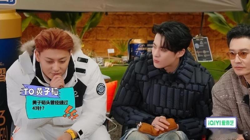 黄子韬因脑淤血手术缝了43针黄子韬在6岁时的一次意外摔倒导致脑淤血，面临生命