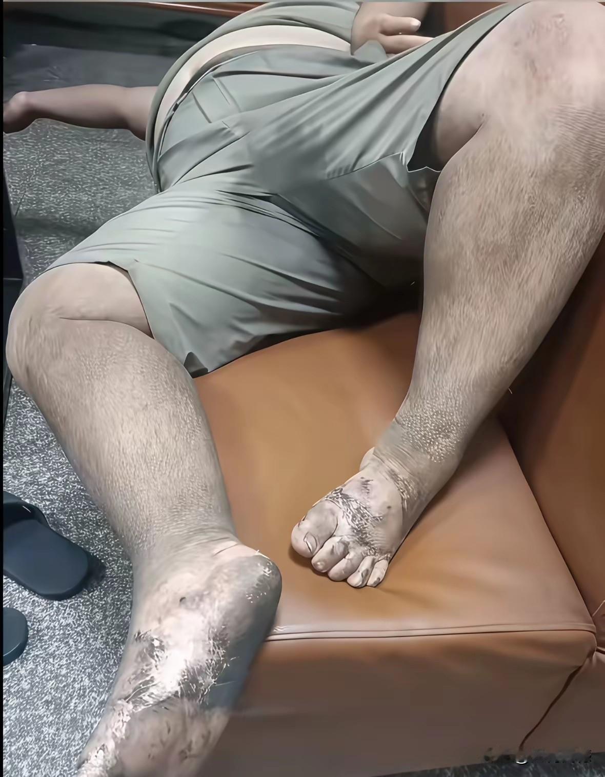 这个送外卖的哥们，这一天也许太辛苦了，每天奔波劳碌，都没有时间把自己的个人卫生整