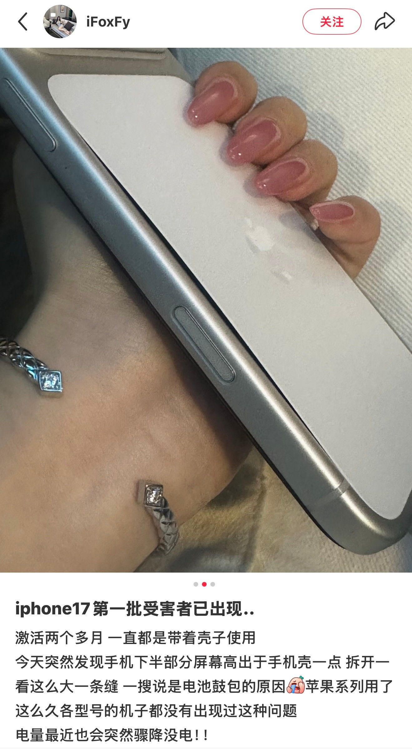 我突然想起来前阵子不是有朋友说我们磁吸壳把他的iPhone17Pro后盖給吸