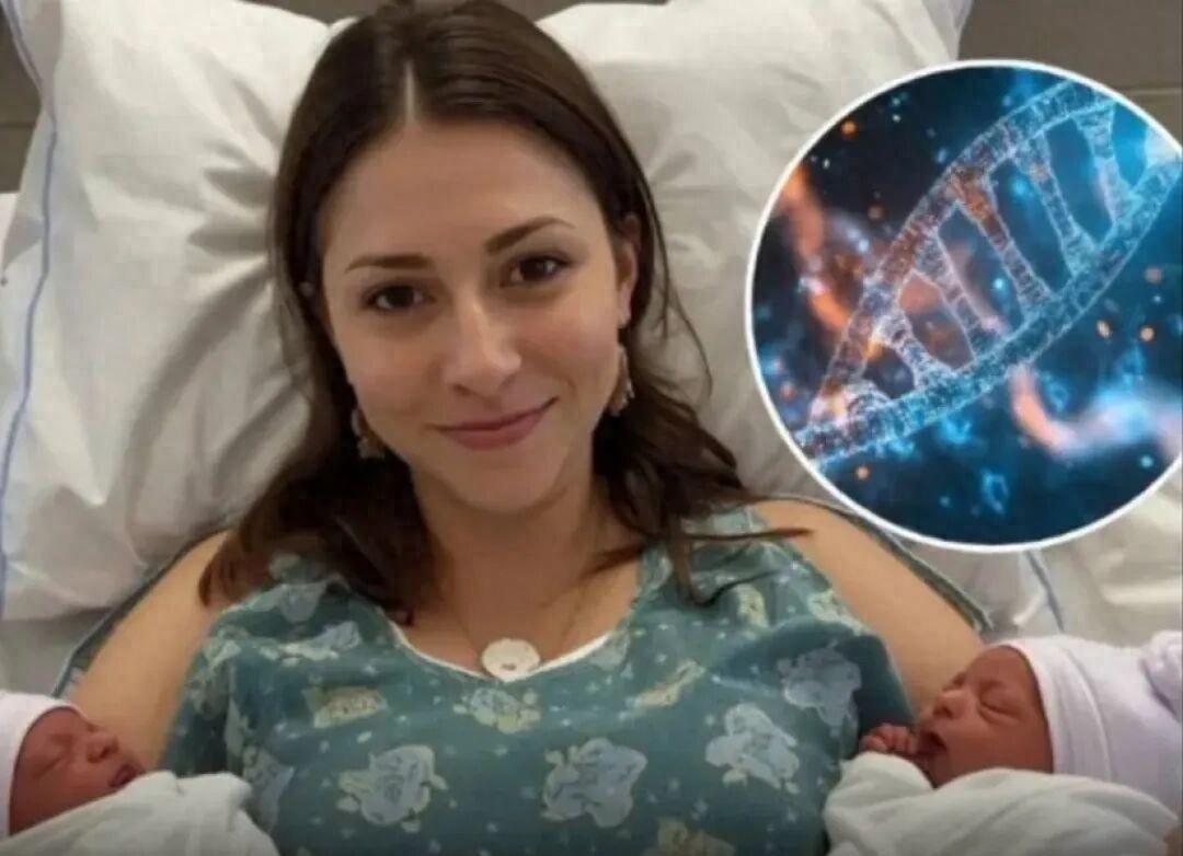 罕见生育事件：巴西女子诞下异父同母双胞胎2022年，巴西，一女子生下双胞胎，全