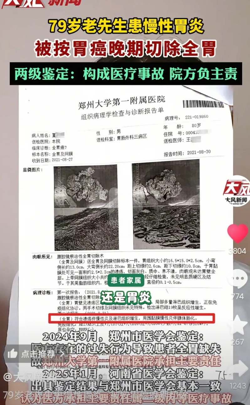 一觉醒来，这医院出名了，为了挣钱不择手段！79岁老人做了胃镜活检，坐诊医生说