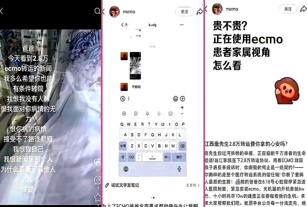 现在去医院打听ECMO转运，现在问到医院都没人愿意理，自从唐先生2.8万和医院纠