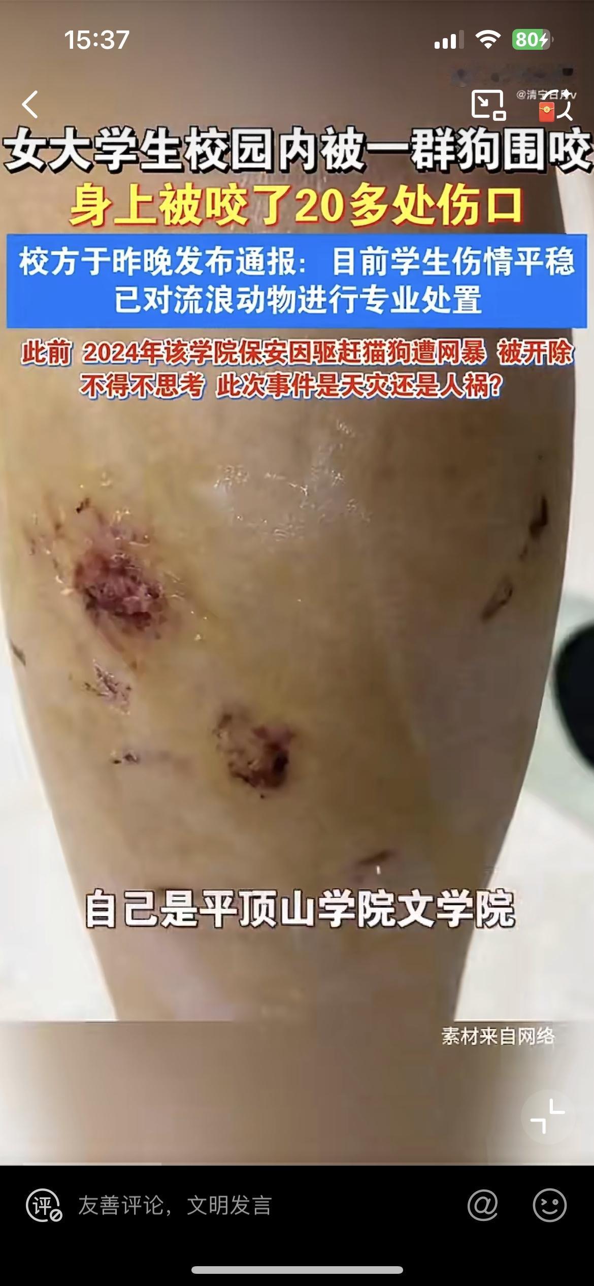 平顶山学院一大三女生校园内遭一群疯狗撕咬，比较讽刺的是，2024年该校保安打流