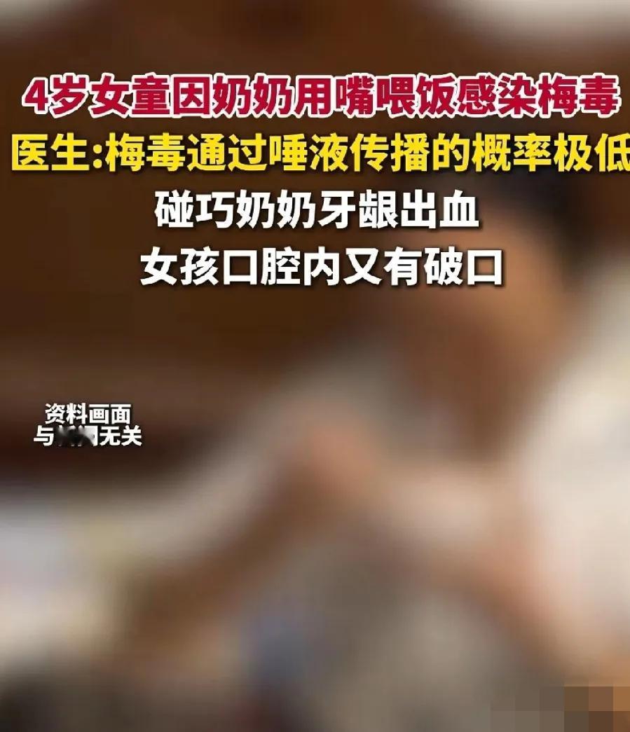 安徽一名4岁女孩被确诊为二期梅毒，感染源是其奶奶。女孩全身长红疹，面部浮肿，