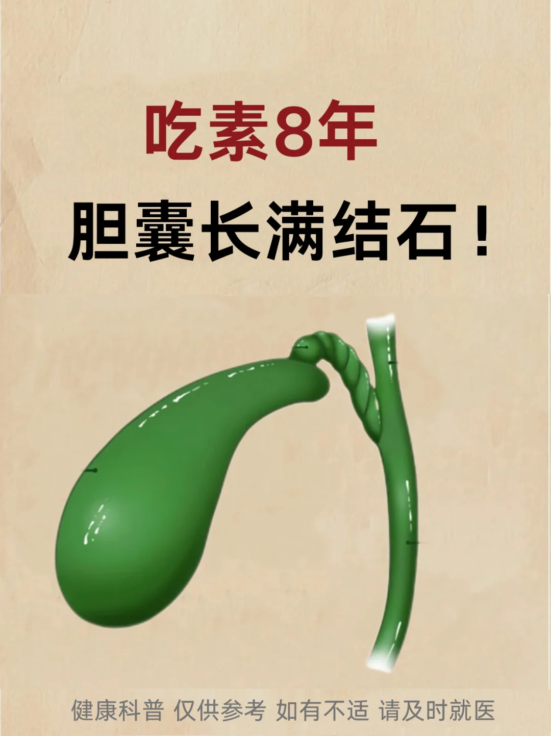 吃素8年，胆囊长满结石！