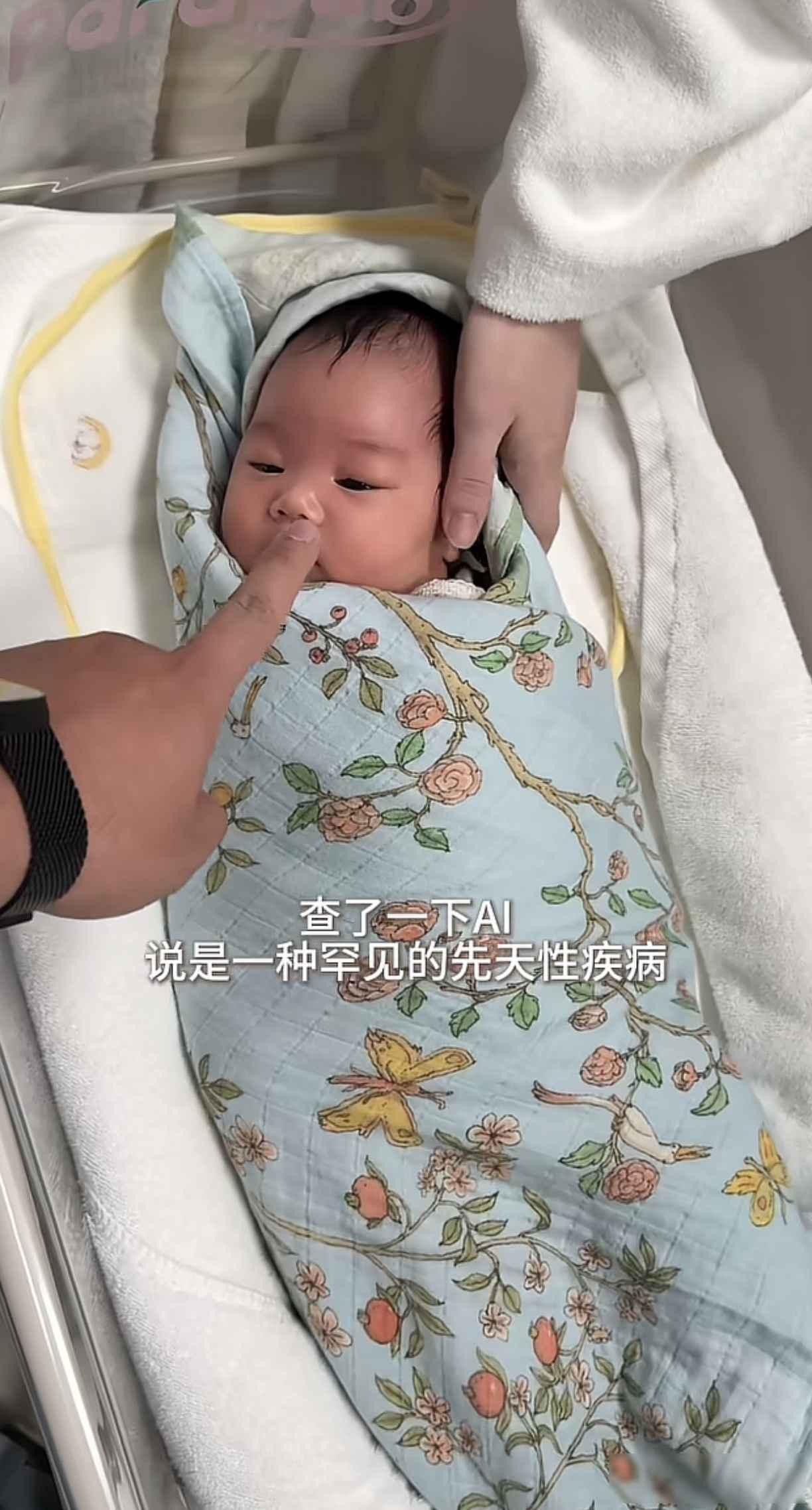 高伯伯的女儿被确诊为先天性眼睑缺损，是一种罕见的先天性疾病！高伯伯最近老盯