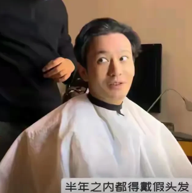 黄晓明乌黑浓密的头发怎么来的？明明头顶感觉脱发严重