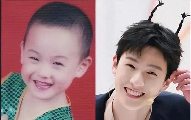 李昀锐以前长的好看吗？为什么都管他叫最好的小张？