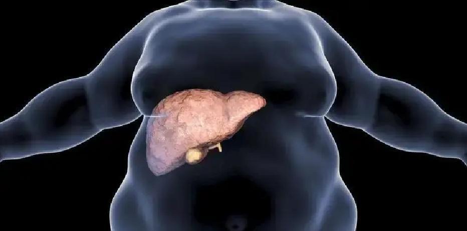 2026年，某城市，数十年轻人被高血脂悄然夺去生命，这到底是什么原因？高血脂作